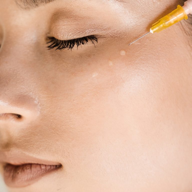 Mesotherapie- Advanced Aesthetic