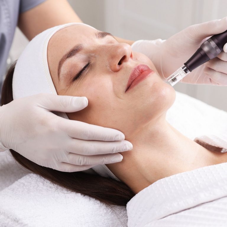 Microneedling - Advanced Aesthetic
